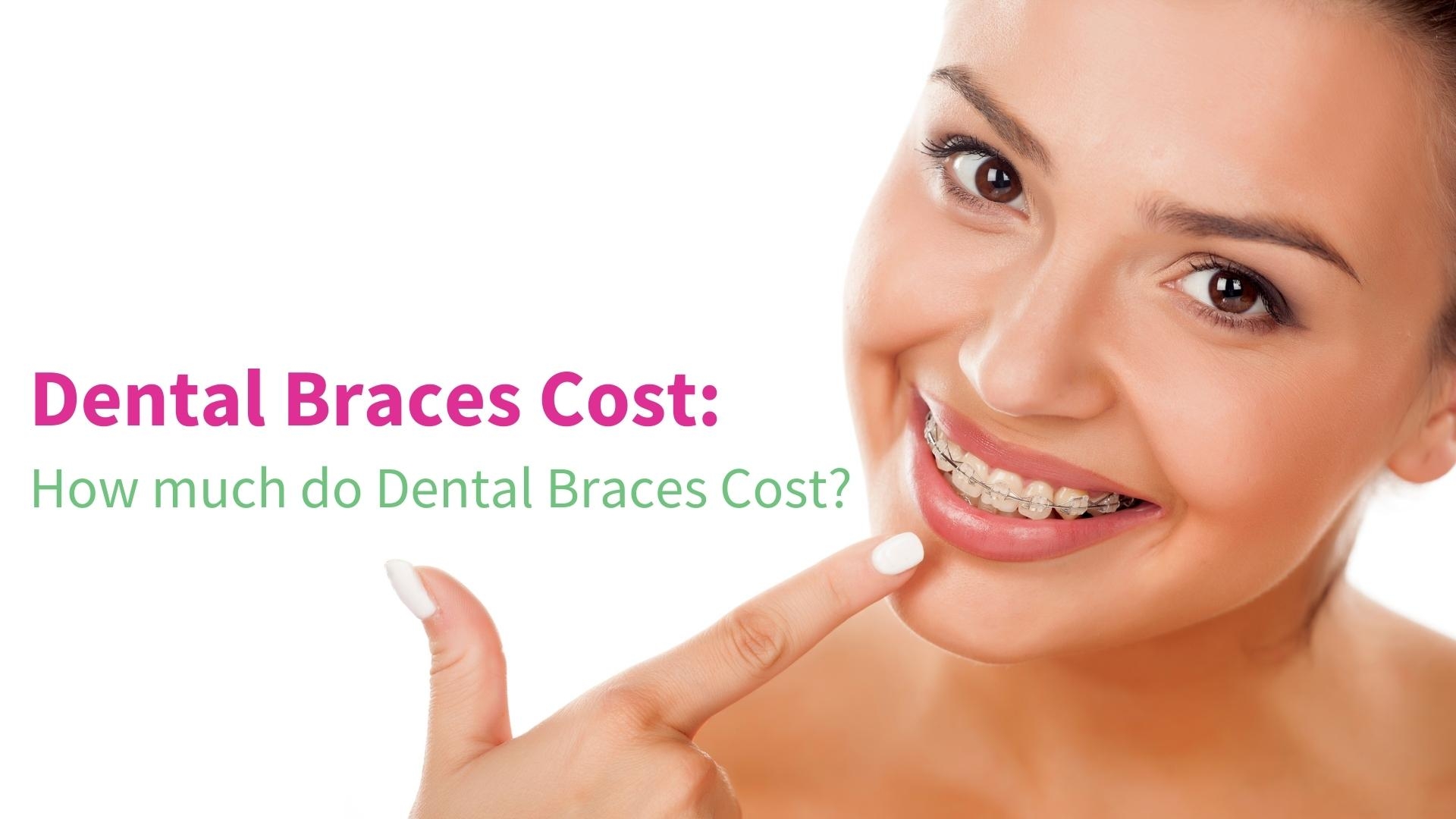 Dental Braces Cost in Noida: How much do Dental Braces Cost? - DR