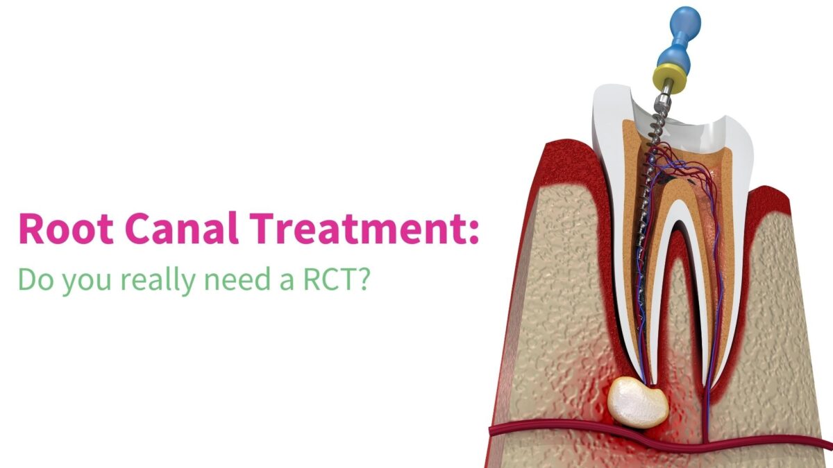 Do you really need a Root Canal, RCT when it needed? DR GUL'S DENTAL