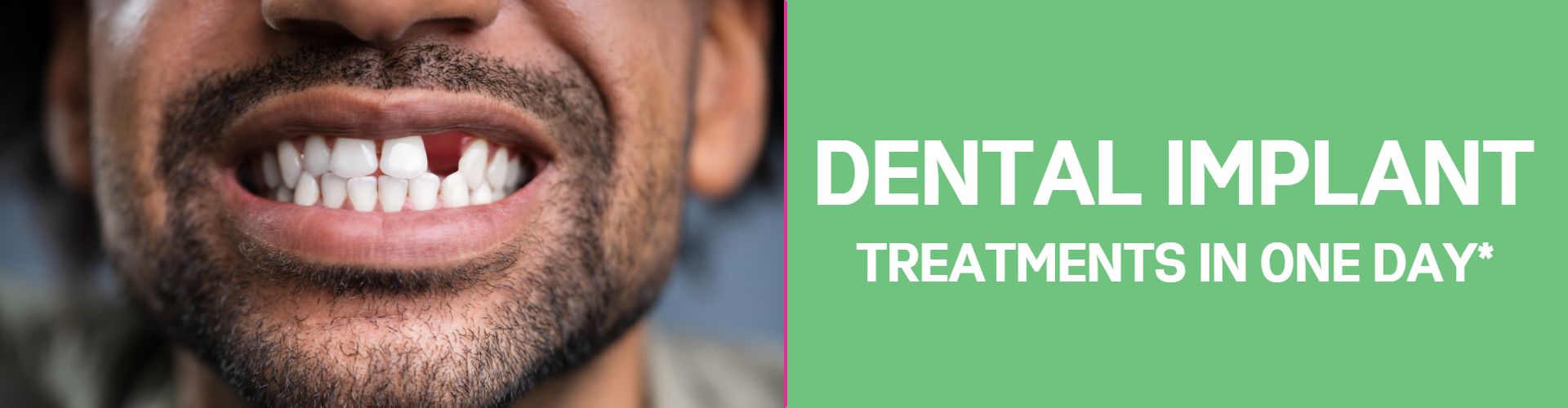 dental implant treatment in noida