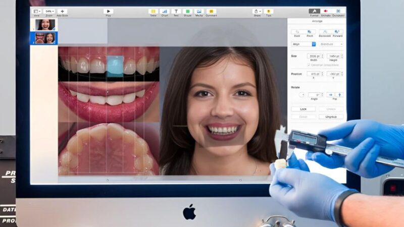 Digital Smile Design in Noida | Dental Clinic in Noida