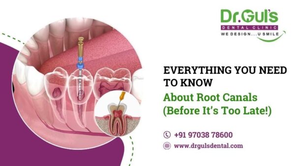 Painless Rct Painless RCT | Dr. Guls Dental Clinic