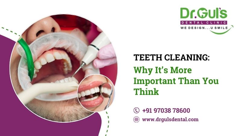 teeth cleaning in noida
