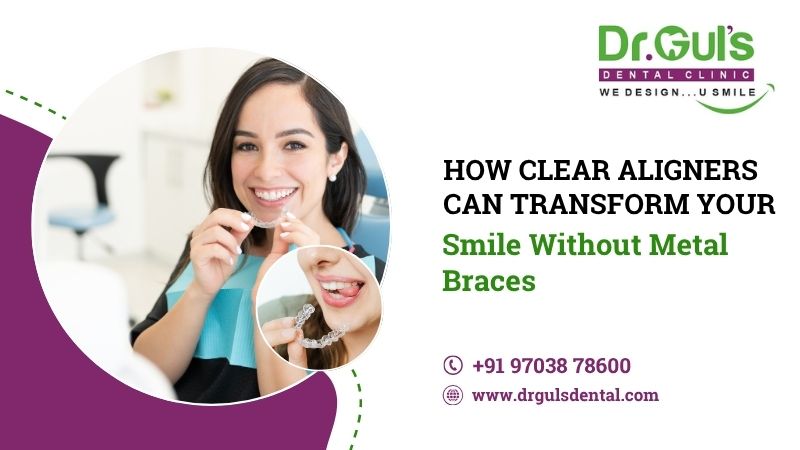 how clear aligners can transform your smile without metal braces