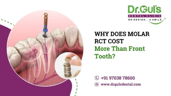 Root Canal Treatment Cost in Noida: Molar vs Front